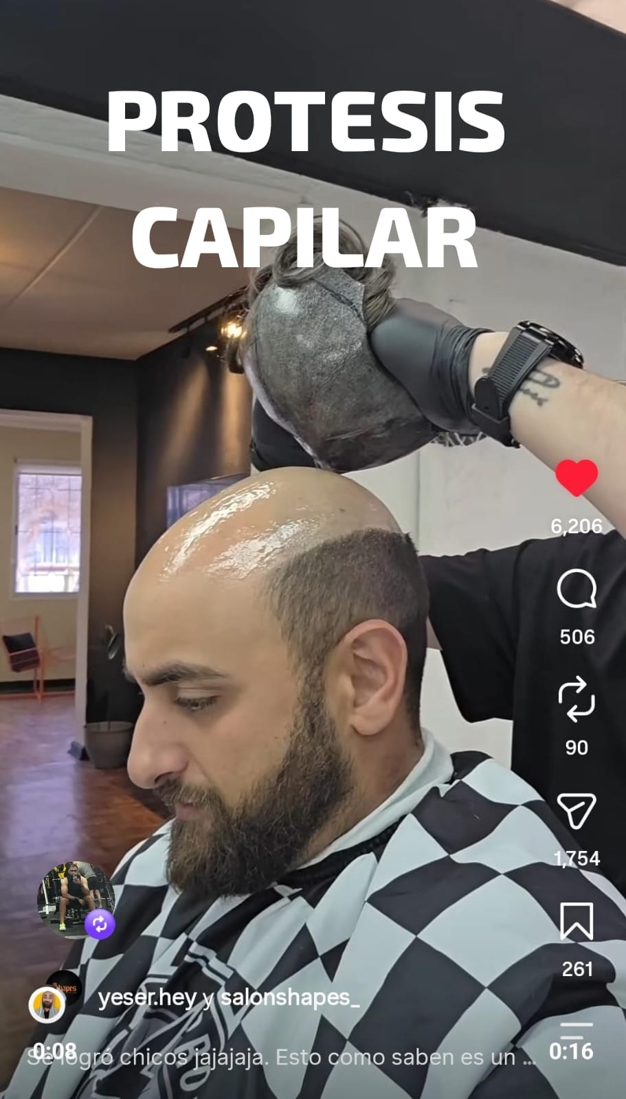 Prótesis capilar para hombre